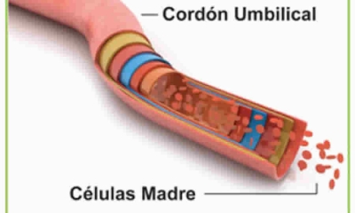 Proyecto presentado ante el Senado busca regular los bancos públicos y privados de células madre de sangre de cordón umbilical